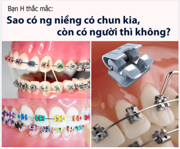 BẠN CHỌN MẮC CÀI THƯỜNG HAY MẮC CÀI TỰ BUỘC?