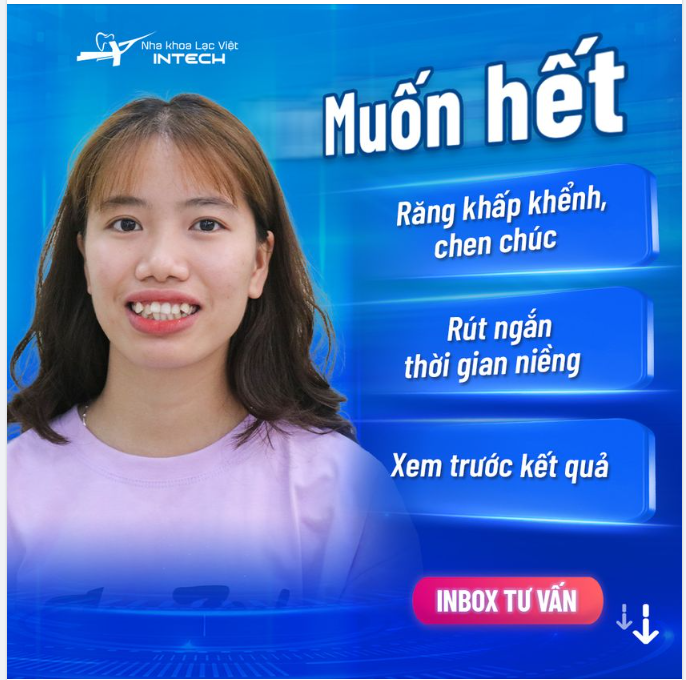 Bạn đang gặp phải tình trạng - răng khấp khểnh -  răng chen chúc và có ý định niềng răng?