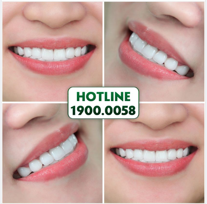 BẤT GIÁC NỞ NỤ CƯỜI - KHOE TRỌN NIỀM HẠNH PHÚC