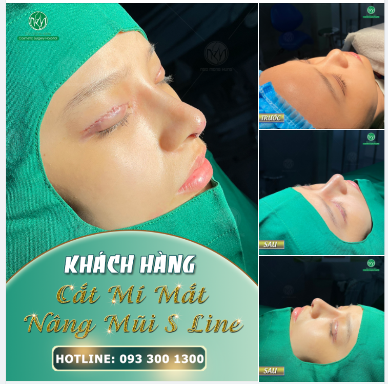 BÍ QUYẾT ĐỂ CÓ KHUÔN MẶT ĐẸP TOÀN DIỆN