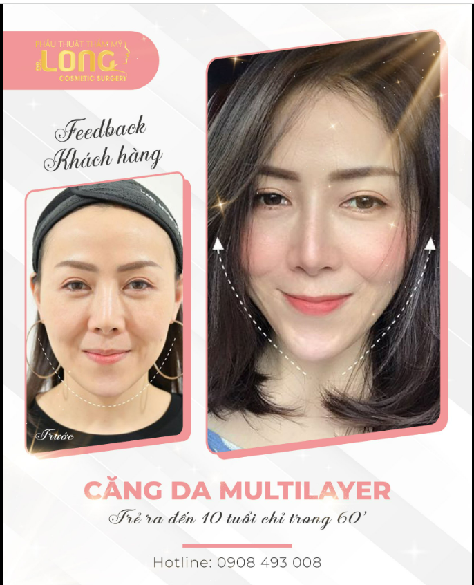 BÍ QUYẾT VÀNG GIÚP NÀNG GÌN GIỮ “THANH XUÂN”