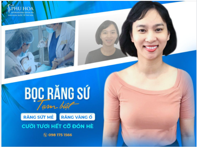 BỌC RĂNG SỨ - CƯỜI TƯƠI HẾT CỠ ĐÓN HÈ