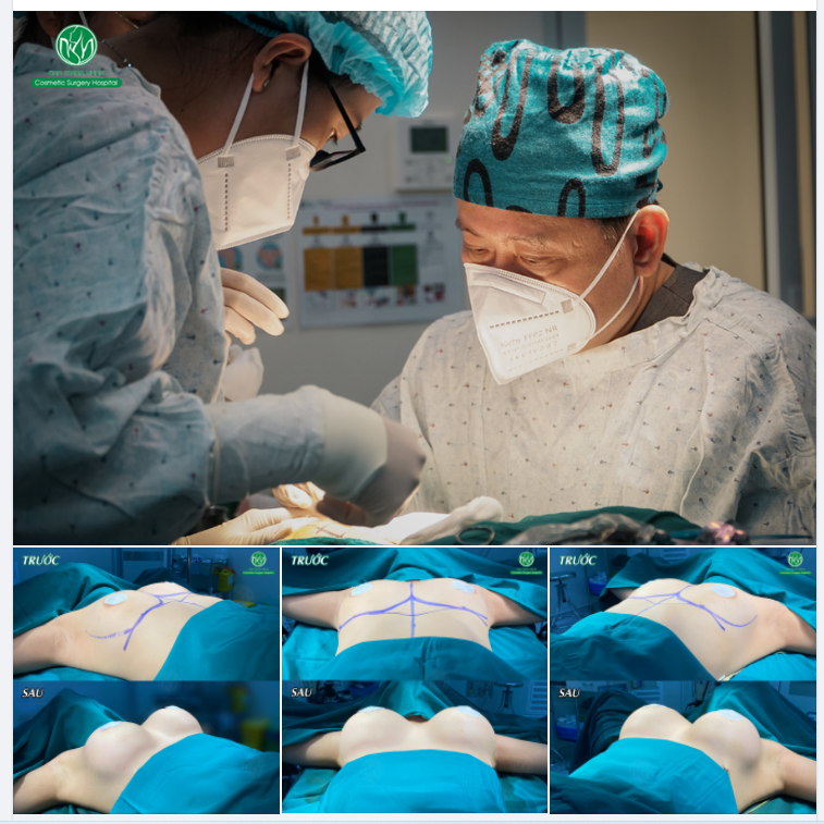 CA NÂNG NGỰC CUỐI NGÀY THỨ 5