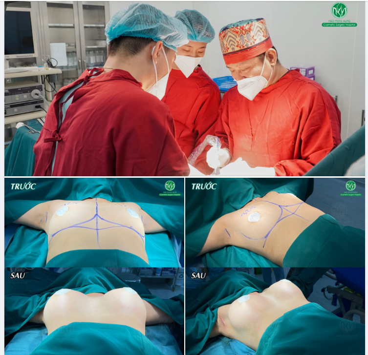 CA NGỰC TIÊU BIỂU TRONG NGÀY