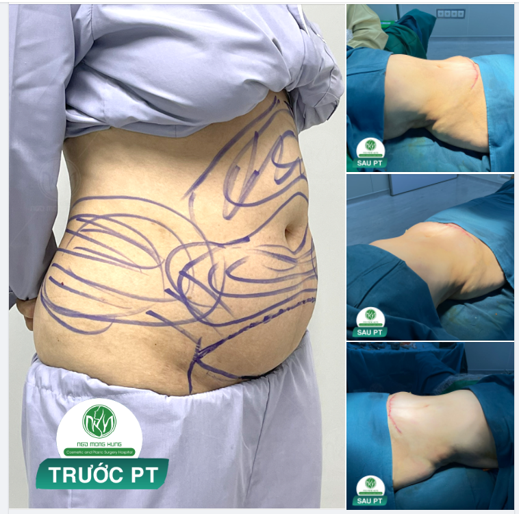 CA PHẪU THUẬT VỪA HOÀN THÀNH 10 PHÚT TRƯỚC