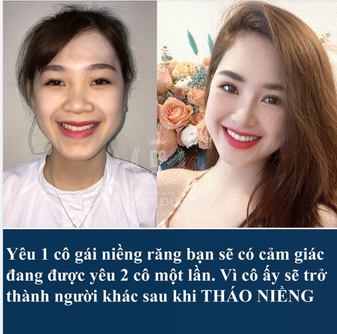 Các anh nhớ nhé