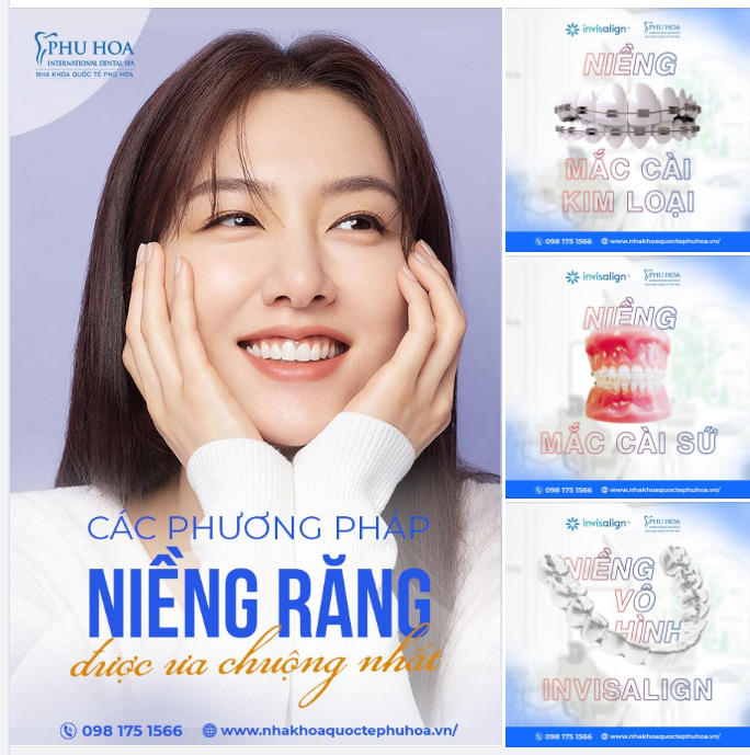 CÁC LOẠI NIỀNG RĂNG ĐƯỢC ƯA CHUỘNG NHẤT