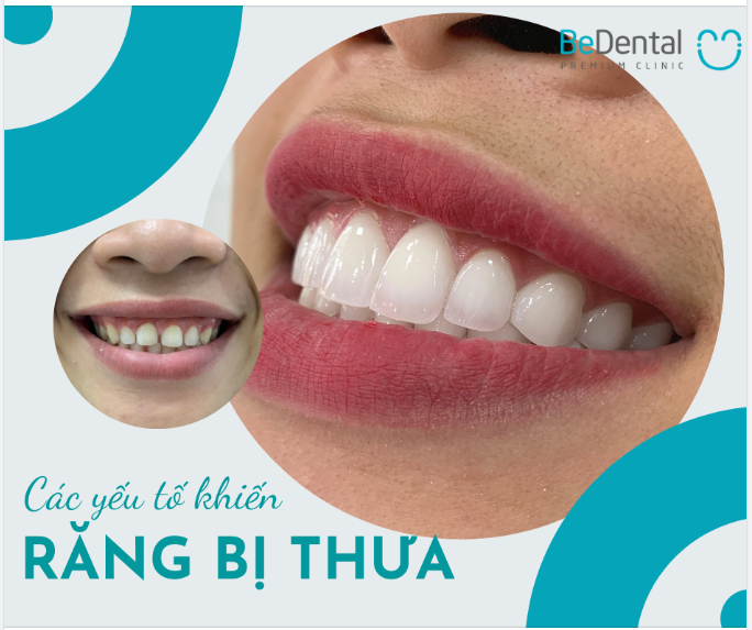 CÁC YẾU TỐ KHIẾN RĂNG BỊ THƯA VÀ CÁCH KHẮC PHỤC