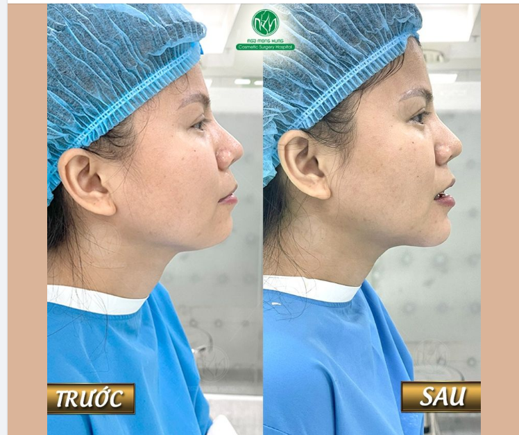 CẰM THON GỌN TÔN LÊN THẦN THÁI TRÊN KHUÔN MẶT