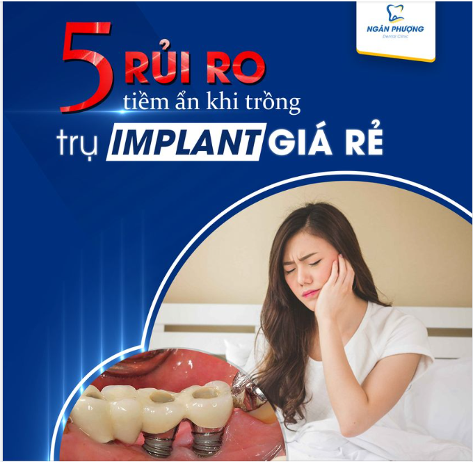 CẢNH BÁO 5 RỦI RO TIỀM ẨN KHI TRỒNG TRỤ IMPLANT GIÁ RẺ