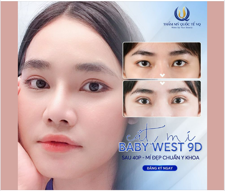 Cắt mí Baby West 9D - Chớp mắt nửa giờ - Mí đẹp bất ngờ - Không chảy máu - Đẹp chuẩn an toàn ƯU ĐÃI 30%.