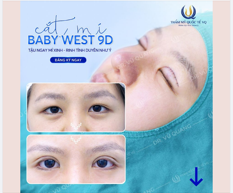 CẮT MÍ BABY WEST 9D - LỘT XÁC TỨC THÌ - XINH ĐẸP BẤT NGỜ