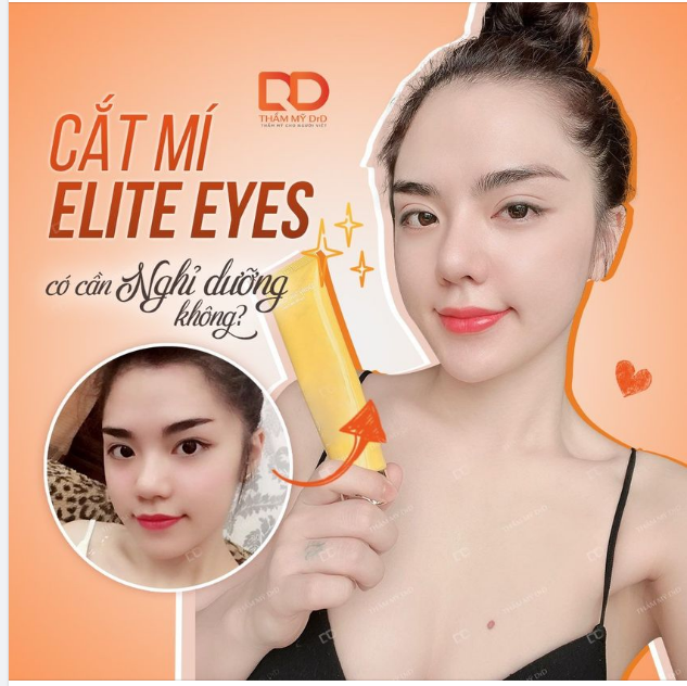 CẮT MÍ ELITE EYES CÓ CẦN NGHỈ DƯỠNG KHÔNG