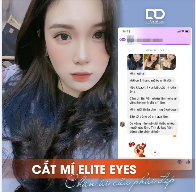 CẮT MÍ ELITE EYES đúng là không làm các nàng thất vọng.