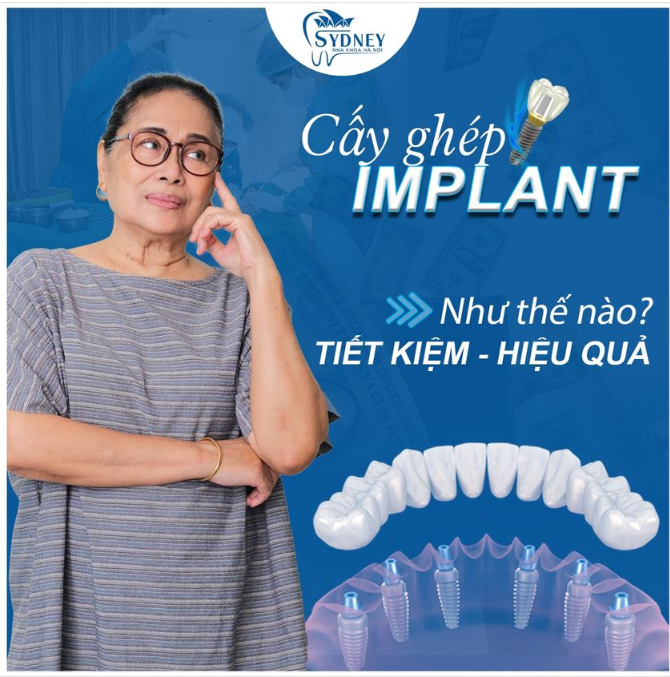 CẤY GHÉP RĂNG IMPLANT NHƯ THẾ NÀO