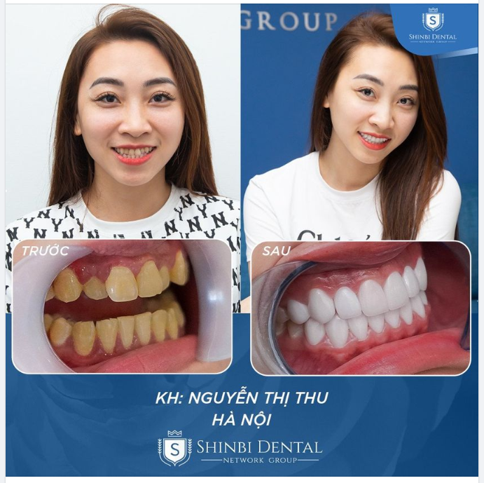 Chăm sóc và yêu thương bản thân mình mỗi ngày các cô gái nhé!