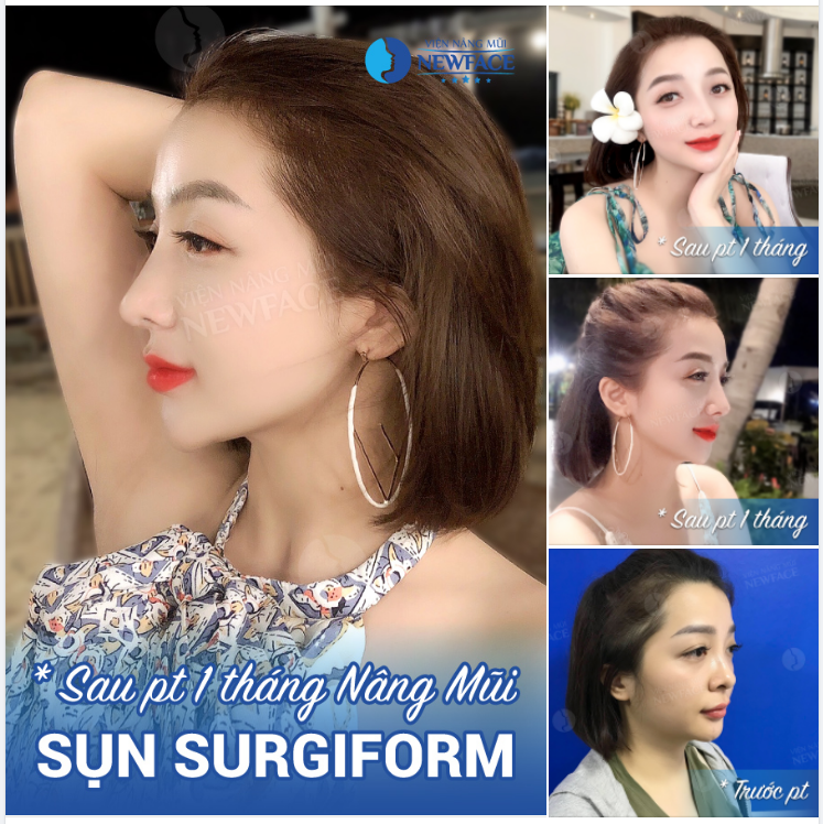 Chẳng cần viết mấy dòng thả thính. Vì chỉ nhìn em thôi là đã đủ “dính”…!