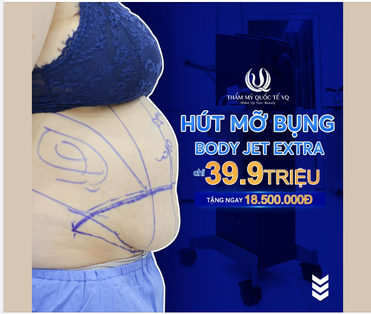 Cháy inbox vì Hút mỡ bụng chỉ 39,9tr - Tặng ngay 18,5tr.