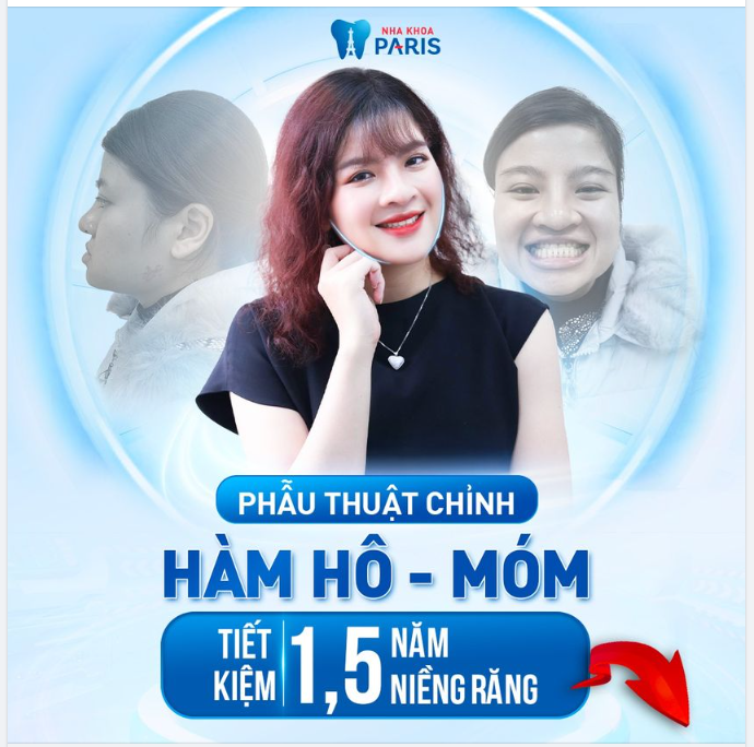 Chỉ 2 giờ phẫu thuật - Sở hữu hàm V-line, thọn gọn, chuẩn khớp cắn.