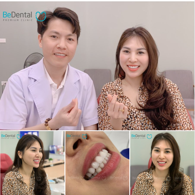 Chị Bích Huệ tái khám tại Nha khoa Bedental