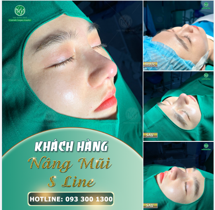 CHỊ EM ĐÃ TÌM ĐƯỢC DÁNG MŨI PHÙ HỢP VỚI MÌNH CHƯA