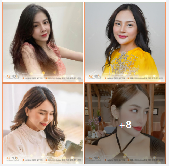 Chị em văn phòng rủ nhau nâng mũi để thay đổi diện mạo