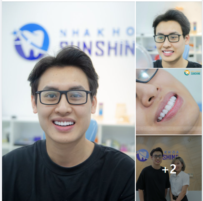 Chỉ sau 2 lần hẹn, bác sĩ sẽ kiến tạo cho khách hàng nụ cười ưng ý nhất