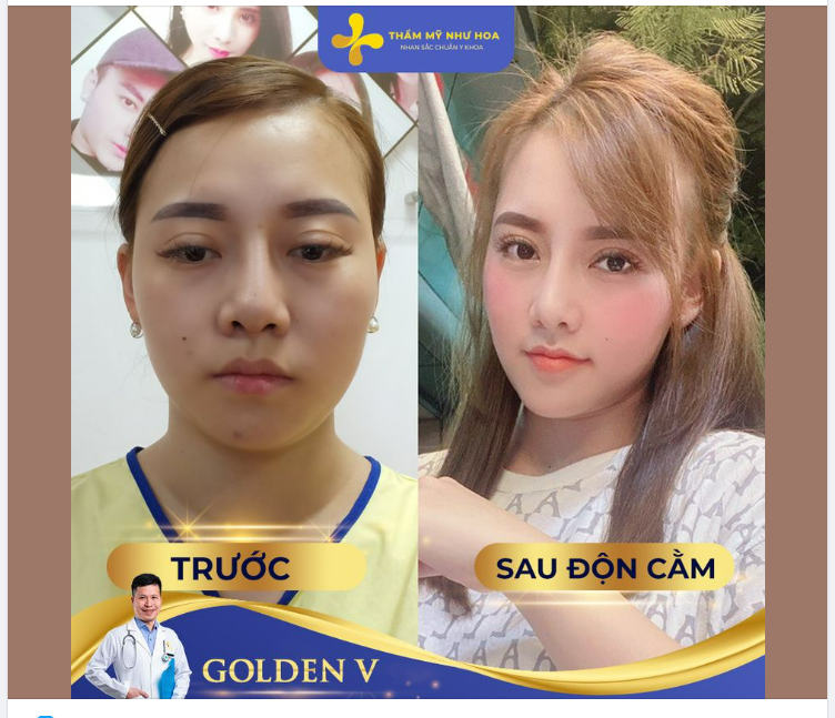 CHI TIẾT TỪNG BƯỚC TRONG MỘT QUY TRÌNH ĐỘN CẰM CHUẨN Y KHOA