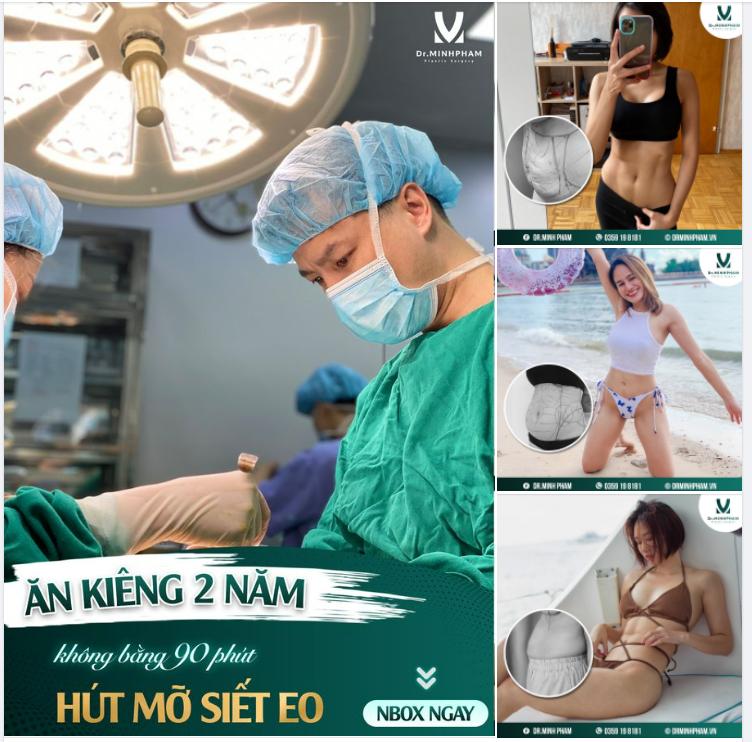 Chia sẻ từ chị khách hàng sau khi thực hiện combo Hút mỡ tạo hình thành bụng tại Dr. Minh Phạm.