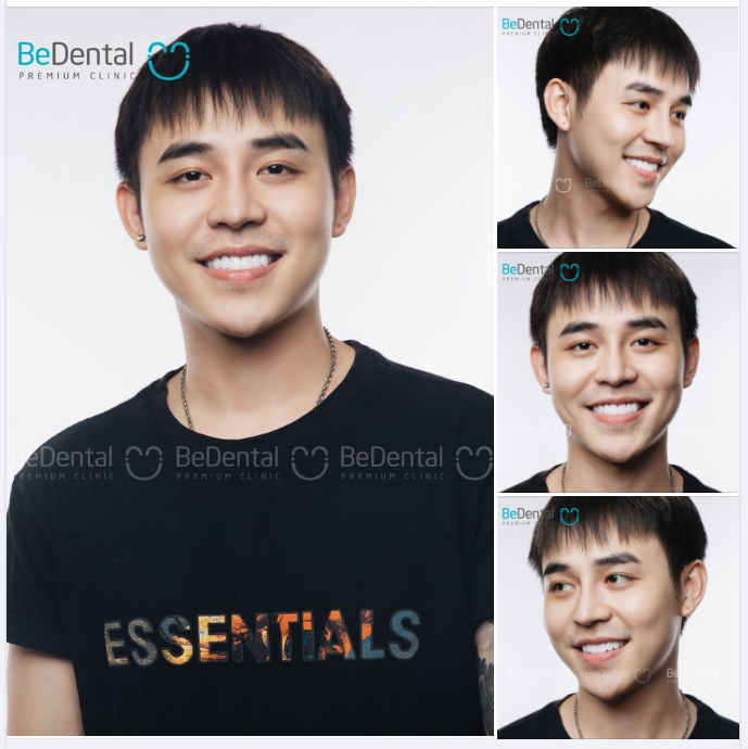 "Chiến thần nụ cười" thay răng đổi vận mệnh