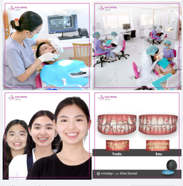 CHỈNH NHA VÀ CÂU CHUYỆN TÁI KHÁM