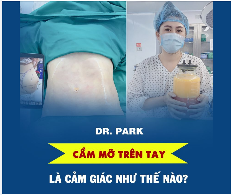 CHÍNH TAY CẦM LƯỢNG MỠ THỪA TRÊN TAY LÀ CẢM GIÁC GÌ