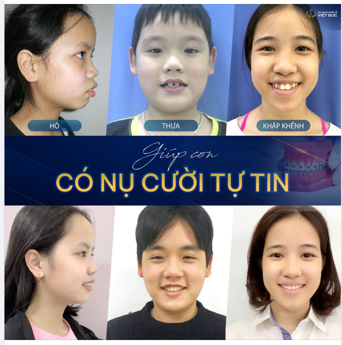 CHO CON NỤ CƯỜI TỰ TIN