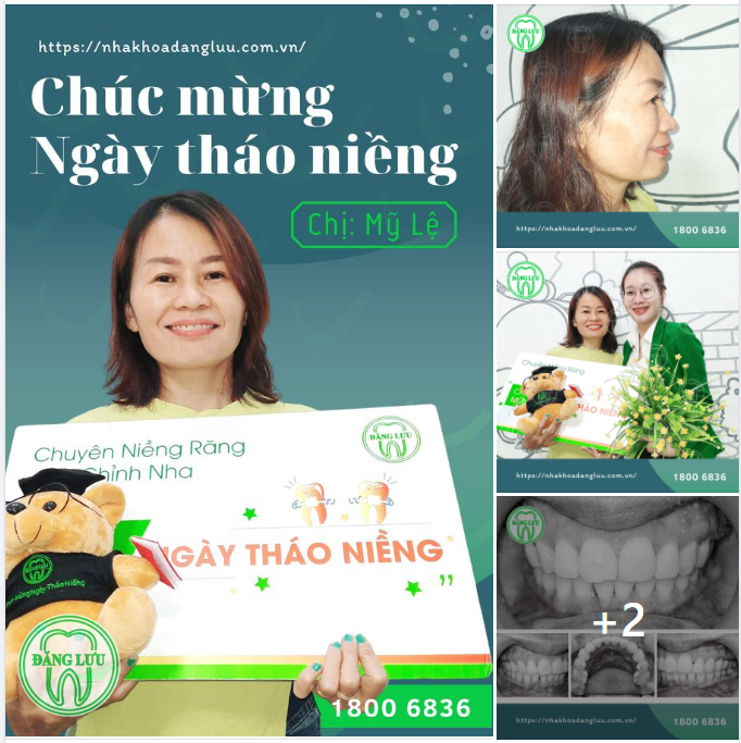 Chúc mừng chị Mỹ Lệ đã sở hữu hàm răng đều đặn - nụ cười tỏa sáng sau khi niềng răng thành công tại Nha Khoa Đăng Lưu! Chúc chị luôn mạnh khỏe, hạnh phúc.