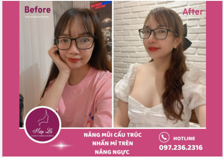COMBO LÊN HƯƠNG NHAN SẮC - ĐẸP KHÔNG TÌ VẾT