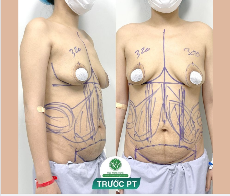 COMBO NÂNG CẤP VÓC DÁNG CHO KHÁCH HÀNG U40