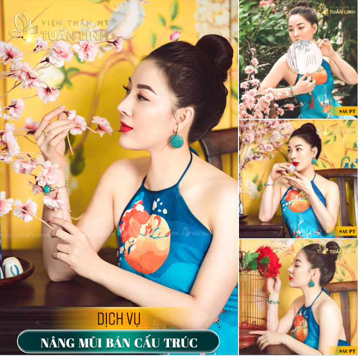 ''CỰC PHẨM'' MŨI BÁN CẤU TRÚC SAU 1 NĂM NÂNG TẠI TUẤN LINH.