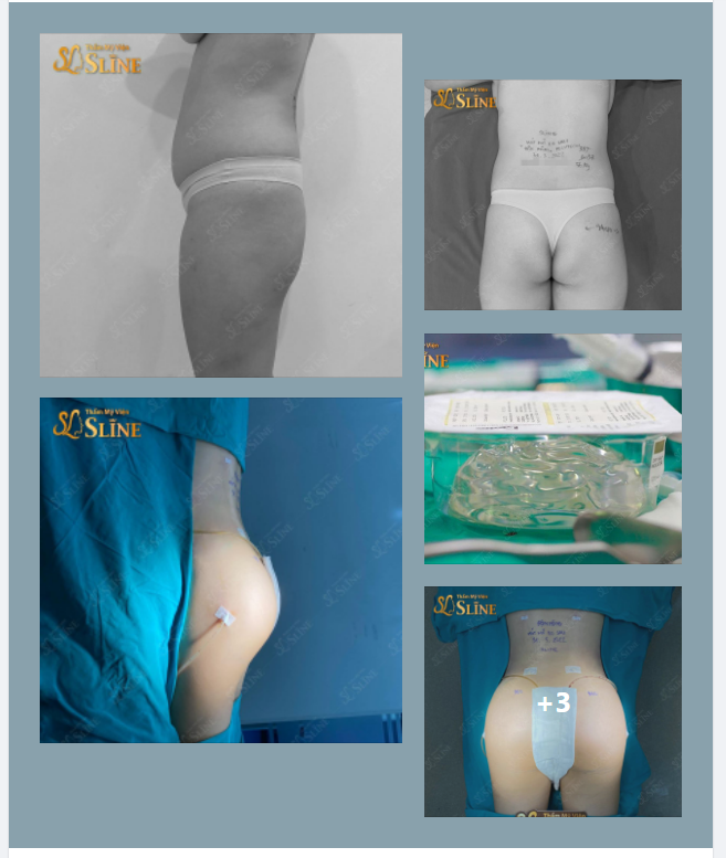 Cũng là túi Gel 360Cc nhưng hôm nay nó lạ lắm....!