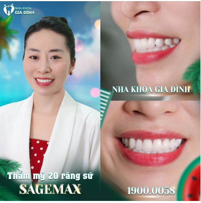 CƯỜI ĐẸP NHƯ MƠ - CHI PHÍ DỄ THỞ