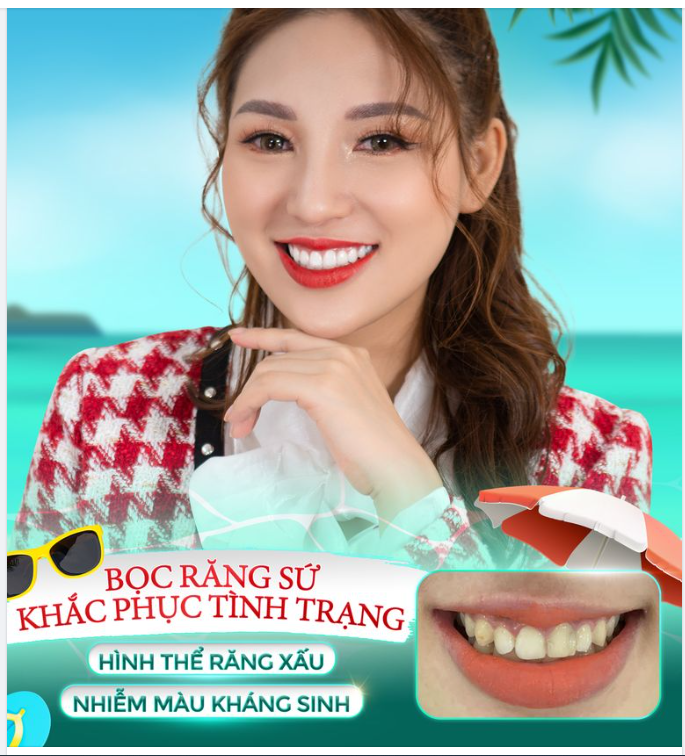 CƯỜI KHÔNG TỰ TIN DO RĂNG XỈN MÀU?