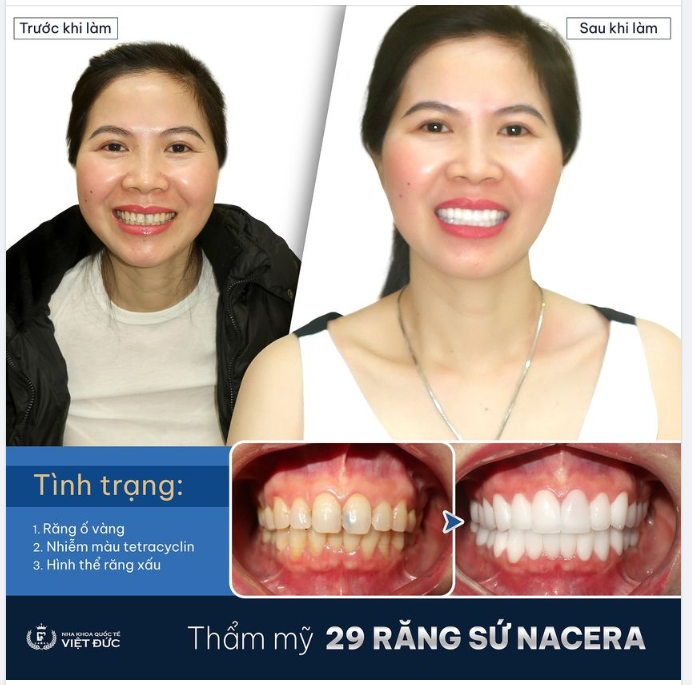 CƯỜI NHIỀU HƠN, TỰ TIN HƠN