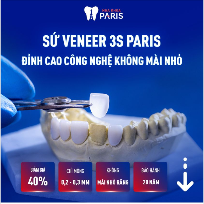 DÁN SỨ VENEER 3S - KHÔNG MÀI RĂNG - 2 BUỔI CÓ NGAY RĂNG ĐẸP