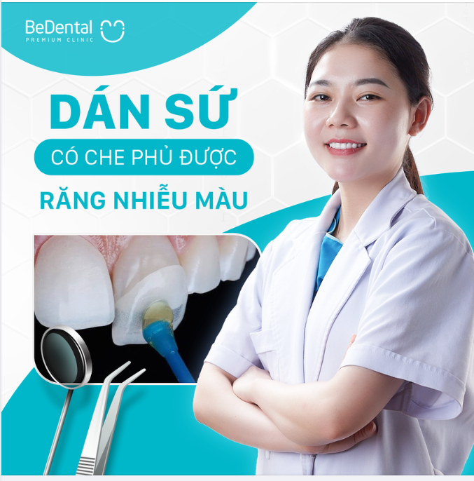 DÁN SỨ VENEER CÓ CHE PHỦ ĐƯỢC RĂNG NHIỄM MÀU?