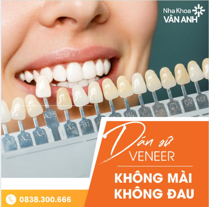 DÁN SỨ VENEER KHÔNG MÀI, KHÔNG ĐAU