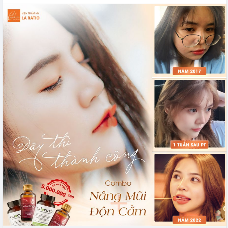 ĐÂY LÀ CÙNG 1 NGƯỜI  BẠN CÓ TIN !! COMBO NÂNG MŨI + ĐỘN CẰM GÂY CHOÁNG