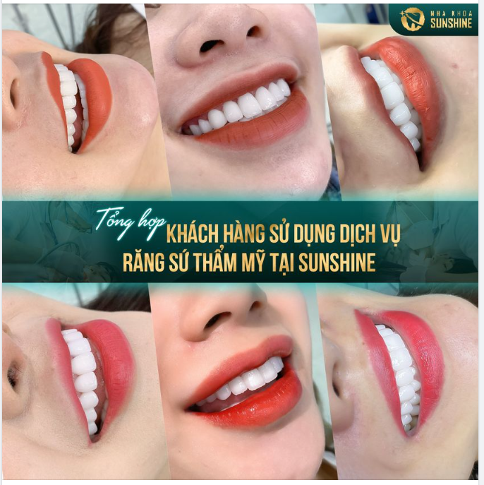 Để có được một nụ cười tỷ lệ hài hoà với khuôn mặt, một hàm răng trắng sáng, đều đẹp và chắc khoẻ