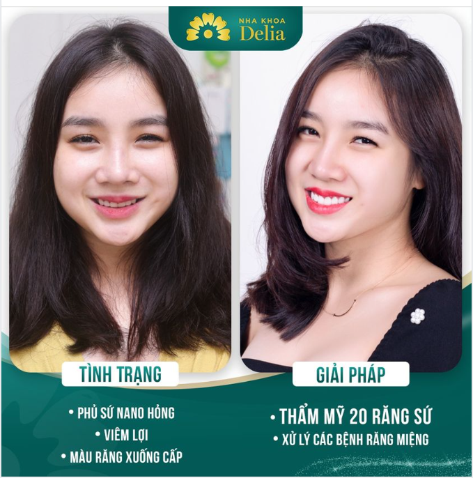 Delia - 24h giải cứu sứ hỏng cho khách hàng Phương Thảo (Hà Nam)