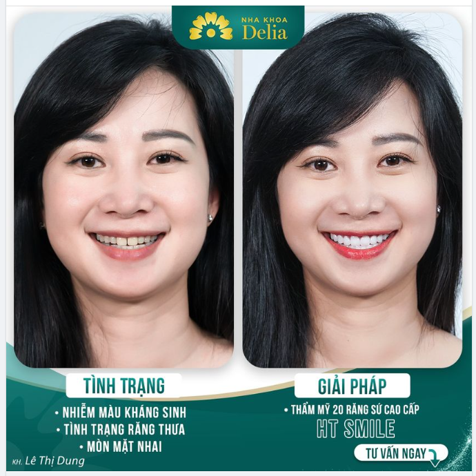 Đến Delia - Nụ cười toả sáng, tự tin bội phần