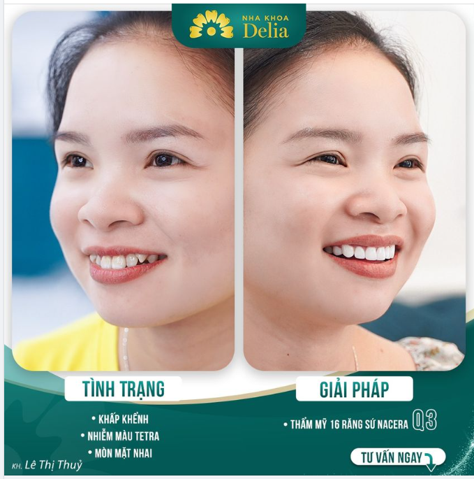 Đến Delia - Tìm lại nụ cười khoẻ - đẹp
