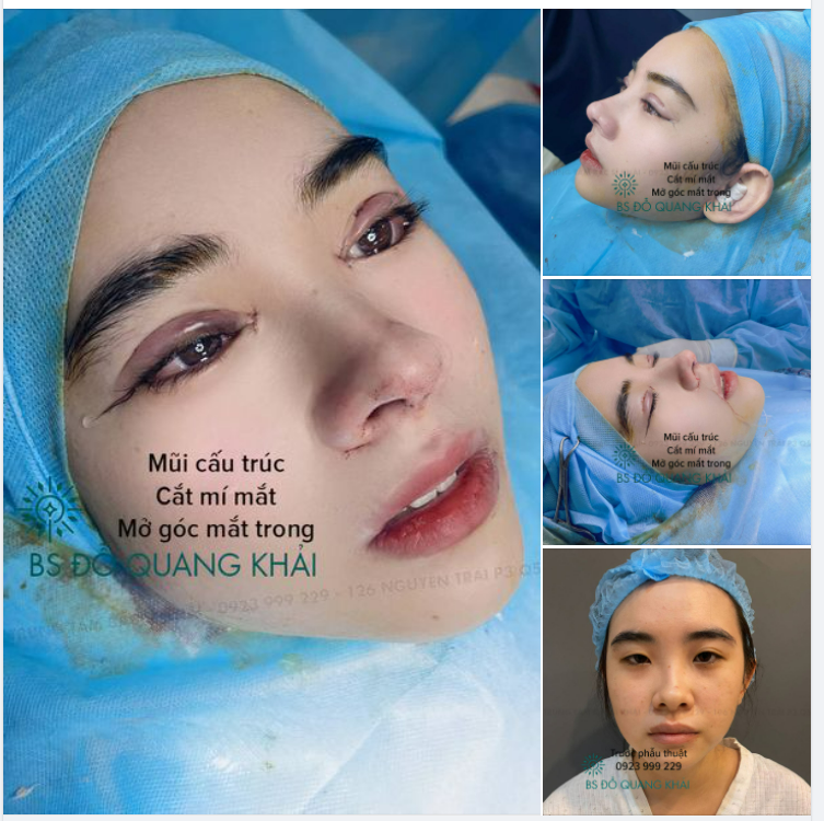 ĐẸP HOÀN HẢO VỚI COMBO CHAO ĐẢO LÒNG NGƯỜI